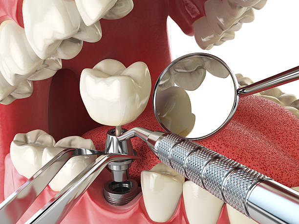 Best Emergency Treatment for Oral Infections in Elbow Lake, MN