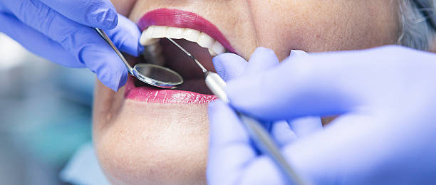 Best Dental Abscess Treatment in Elbow Lake, MN